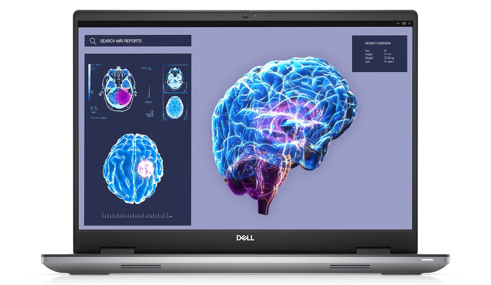 Dell Precision 7680 (2023) Máy Trạm Di động Siêu Bền, Hiệu Năng Vượt Trội 02